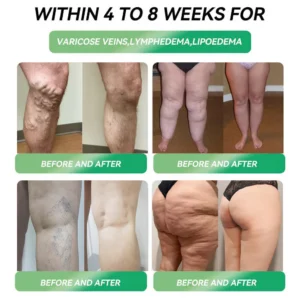 Croaie® Telportide Oral Solution, GIP and GLP-1 Dual