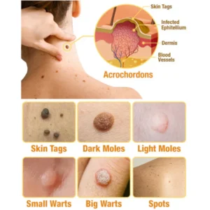 LOVILDS™ TagRecede Bee poison Treatment Spray