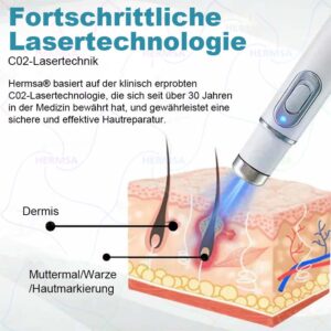 Hermsa® non-invasive laser pointer - mole and wart removal