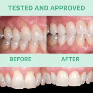 Elycura™ | Get Brighter Smiles & Restore Receding Gums in 93% of Cases Within 4 Days!