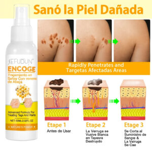 Tag Recede™ Wart Remover Spray