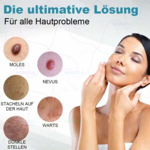 Hermsa® non-invasive laser pointer - mole and wart removal