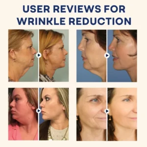 AAFQ®Natural Castor Oil Roll-On| 100% Pure, Unscented, For Radiant Skin