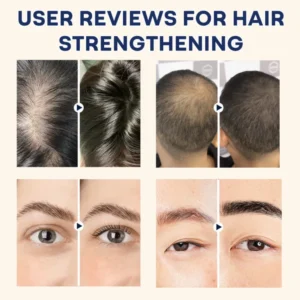 AAFQ®Natural Castor Oil Roll-On| 100% Pure, Unscented, For Radiant Skin