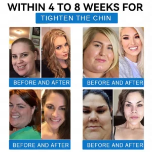 LBMLBM SMGT GLP 1 Tirzepatide & Collagen Nano