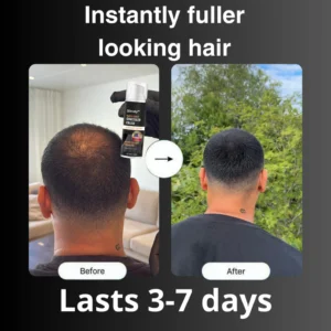 Slimoly™ Hair & Scalp Concealer 50ML - Waterproof 3–7 days