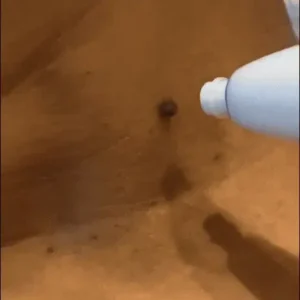 Bikenda™ Complete Set Bundle