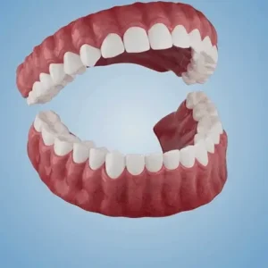 NESLEMY™Advanced Customized Full Denture Set