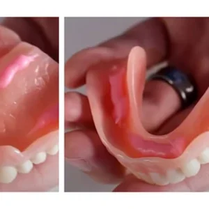 Yagoo™-Custom-Fit Full Functional Dentures