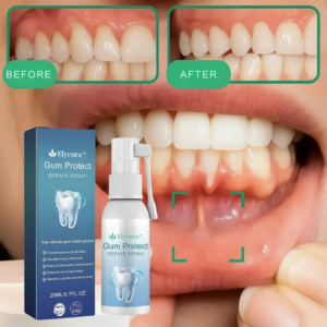 Elycura™ | Get Brighter Smiles & Restore Receding Gums in 93% of Cases Within 4 Days!