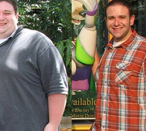 YooFibre Glutathione Liver Detox Nano-Microneedle Patches