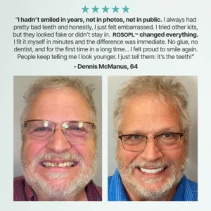 ROSOPL™ Custom-fit, fully functional dentures