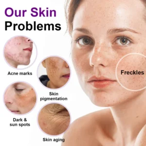 Alisanda® SpotErase Probiotic Shield Serum