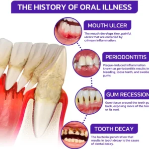 Alisanda® Bee Venom Dental Treatment Toothpaste