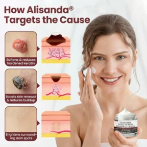 Alisanda® Dual-Action Renewal Cream
