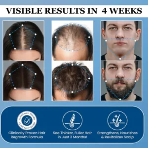 Alisanda® Hair Growth Roll on Serum