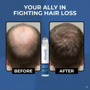 Alisanda® Hair Growth Roll on Serum
