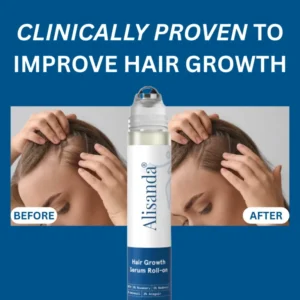 Alisanda® Hair Growth Roll on Serum