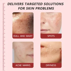 Alisanda™ Pore & Spot Care Duo| Shrinks Pores & Fades Blemish Marks