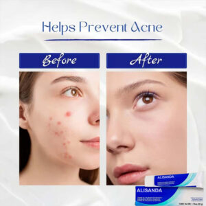 Alisanda® Clear Radiant Skin Fast Renewal Formula