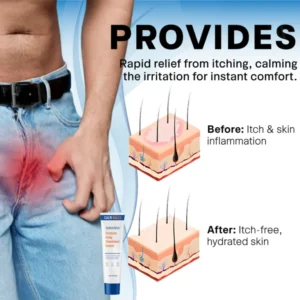 Alisanda® Scrotum Itchy Treatment Cream